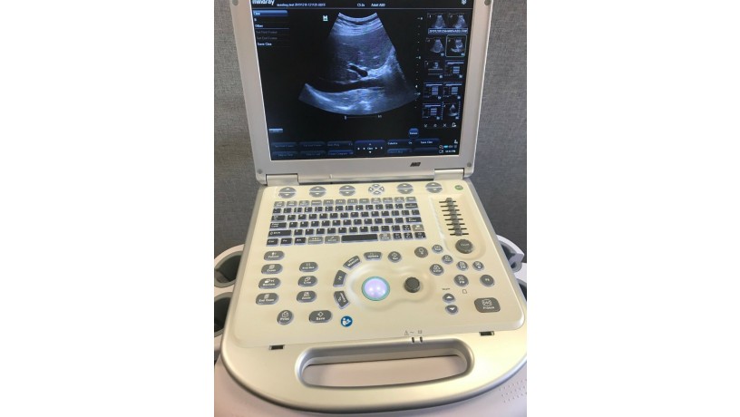 mindray-m7-ultrasound-machine-big-1